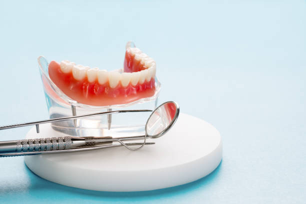 Full Mouth Reconstruction in South Salt Lake, UT